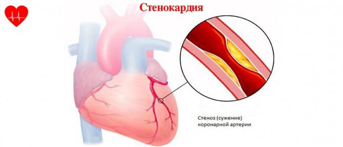 Анализ что означает мно