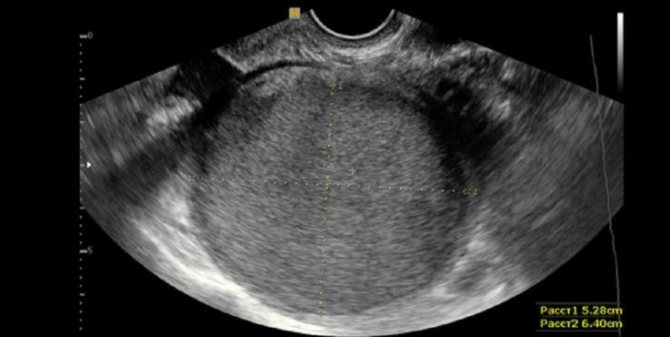 диагностика