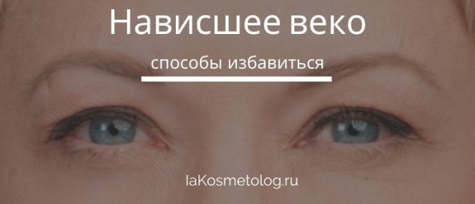 Как подтянуть верхнее веко - в домашних условиях, операция, маски