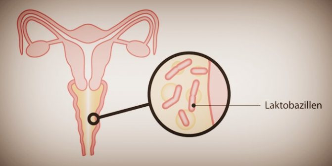 Превышение лактобактерий