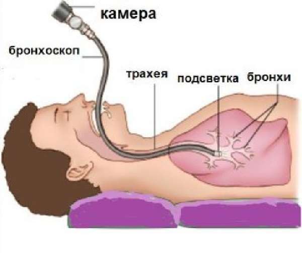 Техническая сторона